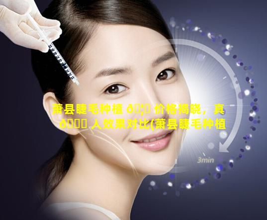 萧县睫毛种植 🦆 价格揭晓，真 🐋 人效果对比(萧县睫毛种植价格揭晓,真人效果对比)